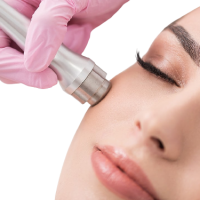 Dermabrasion