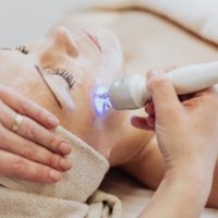 Laser Treatment